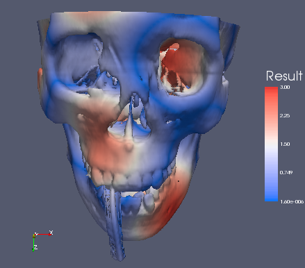 Image:ColorMapSkullMsh3.png
