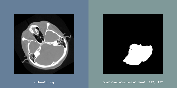 ITK Examples Baseline ImageSegmentation TestConfidenceConnectedImageFilter.png